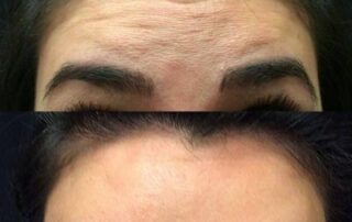 Cliente en consultation